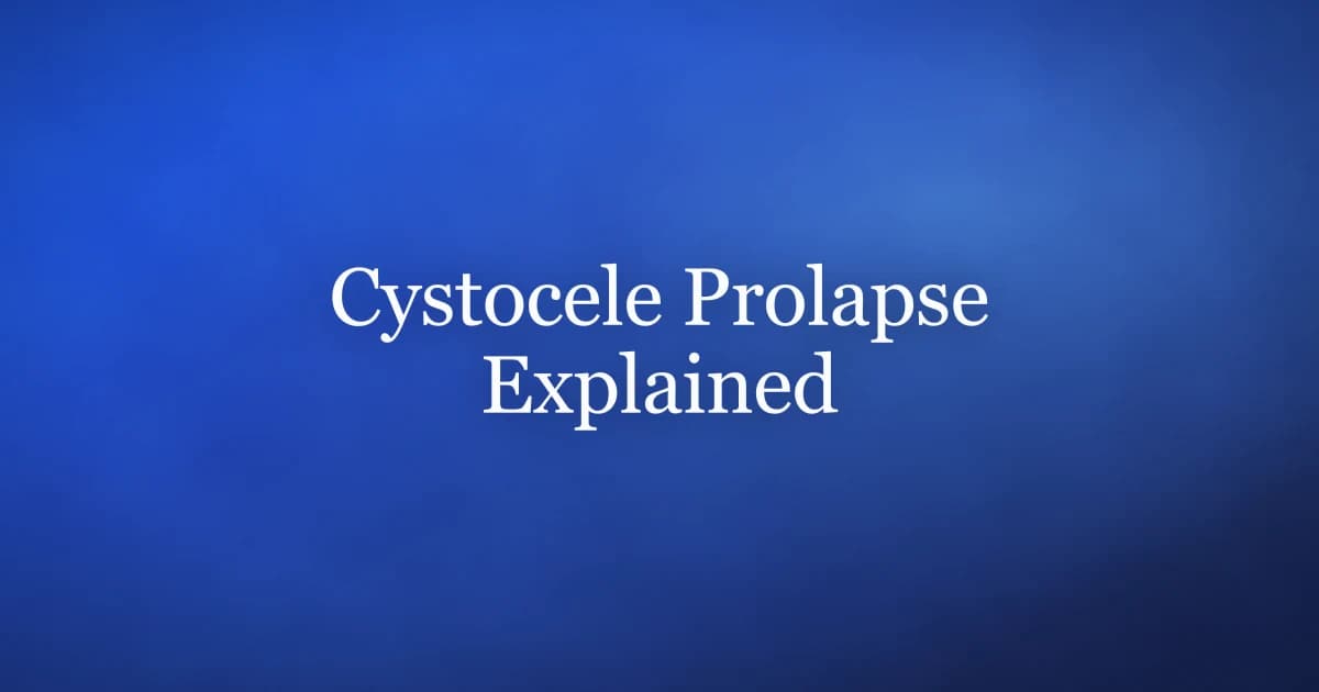 Cystocele Prolapse: What It Is and the Pelvic Floor Link